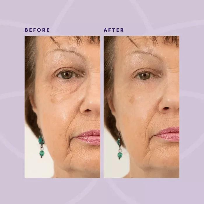 1+1 GRATUIT | Crème raffermissante pour les yeux Lighteme Wrinkle Eraser