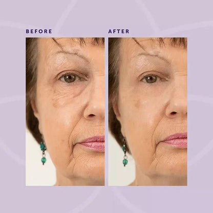 1+1 GRATUIT | Crème raffermissante pour les yeux Lighteme Wrinkle Eraser