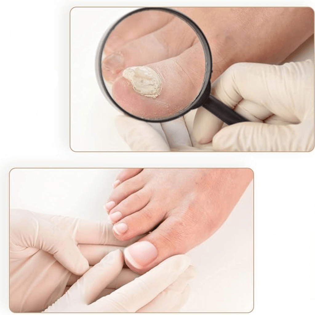 Lighteme Nagelpflaster &amp; Nagelpatches – Schmerzfreie Nagelpflege
