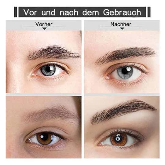 Lighteme Gesichtsepilierer – Seidig glatte Haut auf Knopfdruck 